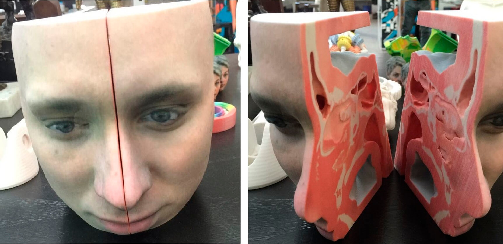 3D model for surgical procedures.