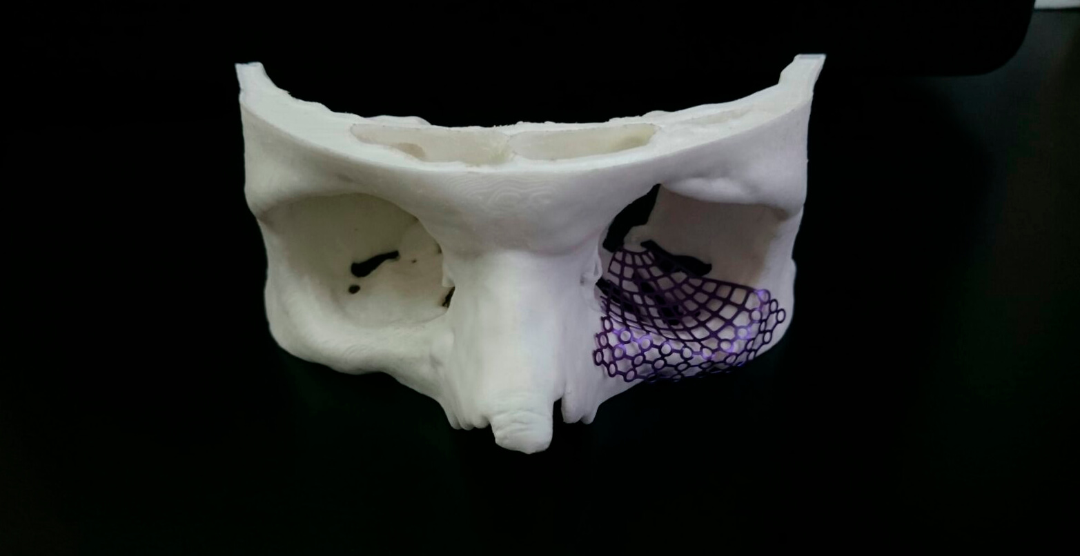 3D printing can help address the backlog of surgeries.